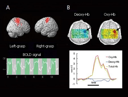 Comparison of BOLD-fMRI (A) and fNIRS (B) for Normal Healthy Adult