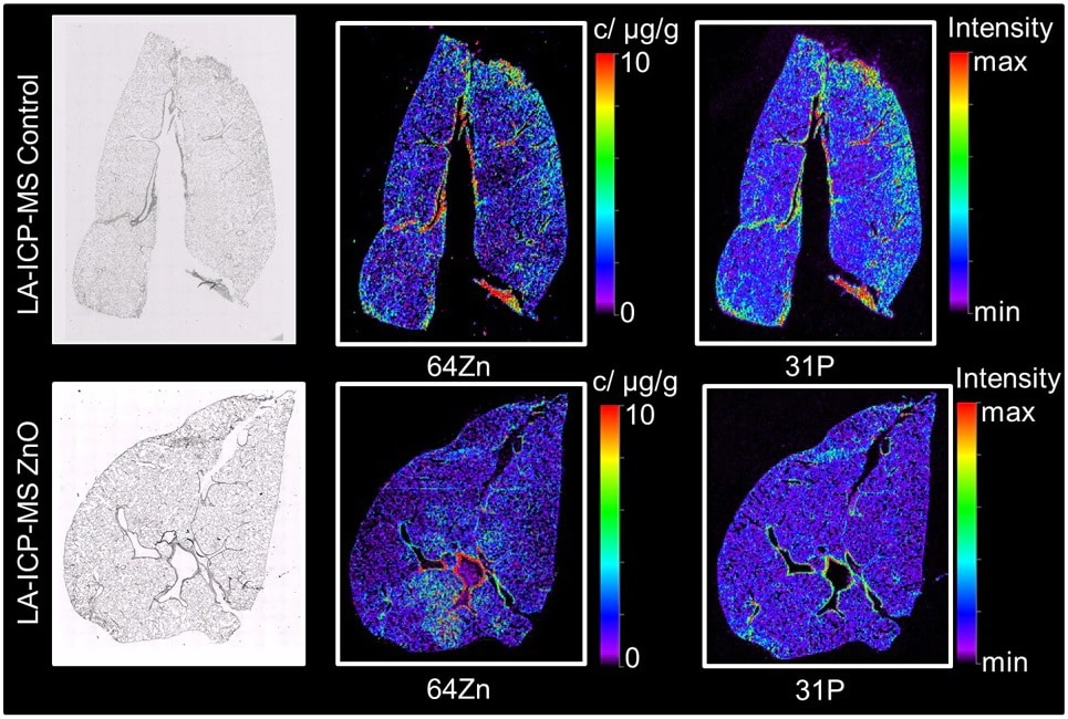 Imaging of Lung Sections of Rats Exposed to Zinc Oxide Nanoparticles