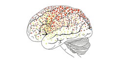 Life Science - Brain-Function Imaging