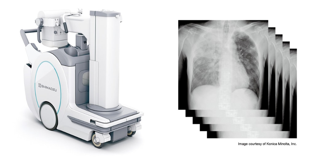 Left: MobileDaRt Evolution MX8 Version k type; Right: Example of Serial Radiography Images