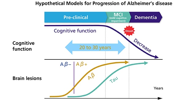 Hypothetical Models for Progression of Alzheimer’s disease