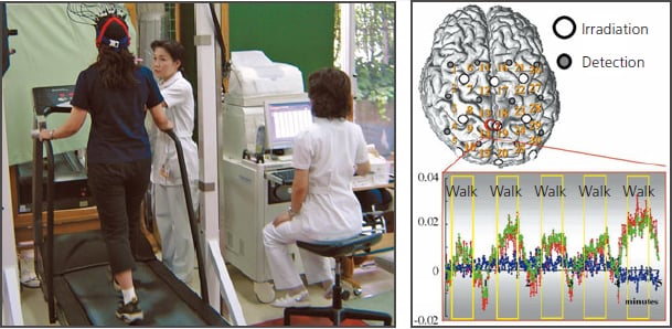 fNIRS Measurement of Brain Activation while Walking on a Treadmill