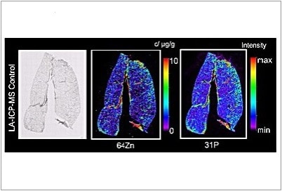 Bioimaging to determine the distribution of nanoparticles and phospholipids in lung tissue