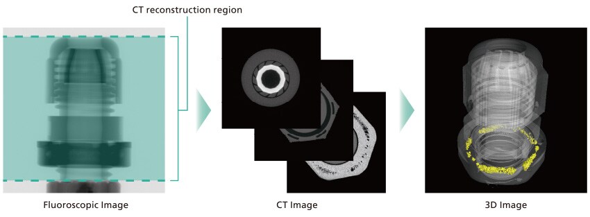 Fluoroscopic Image / CT Image / 3D Image