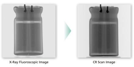 X-Ray Fluoroscopic Image / CR Scan Image