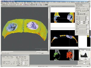 3D Image Processing Software