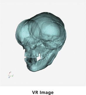 Bone: tarsier