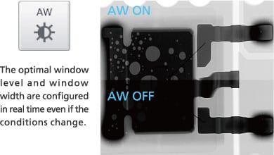 Image Adjustment Functions (Auto Window Function and Area of Interest Function)