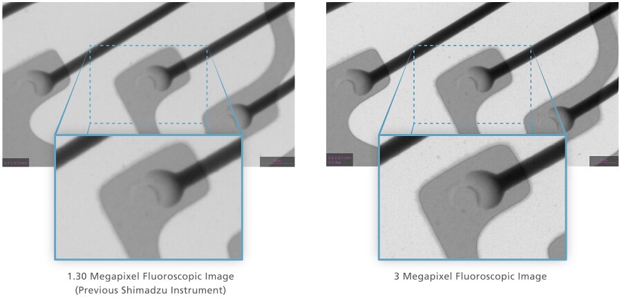 Equipped with a 3 Megapixel Flat Panel Detector