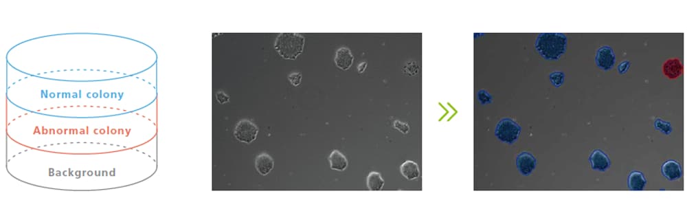 Detection of abnormal cells / colonies