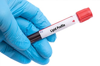 Lipid Profiling