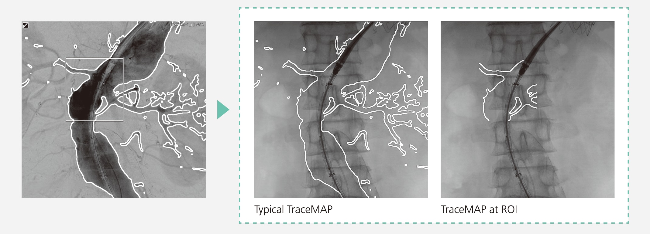 TraceMAP(SCORE MAP)