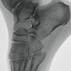 Low Enhancement image