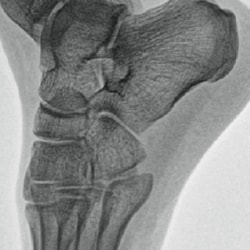 High Enhancement image