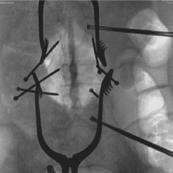 Low Enhancement image