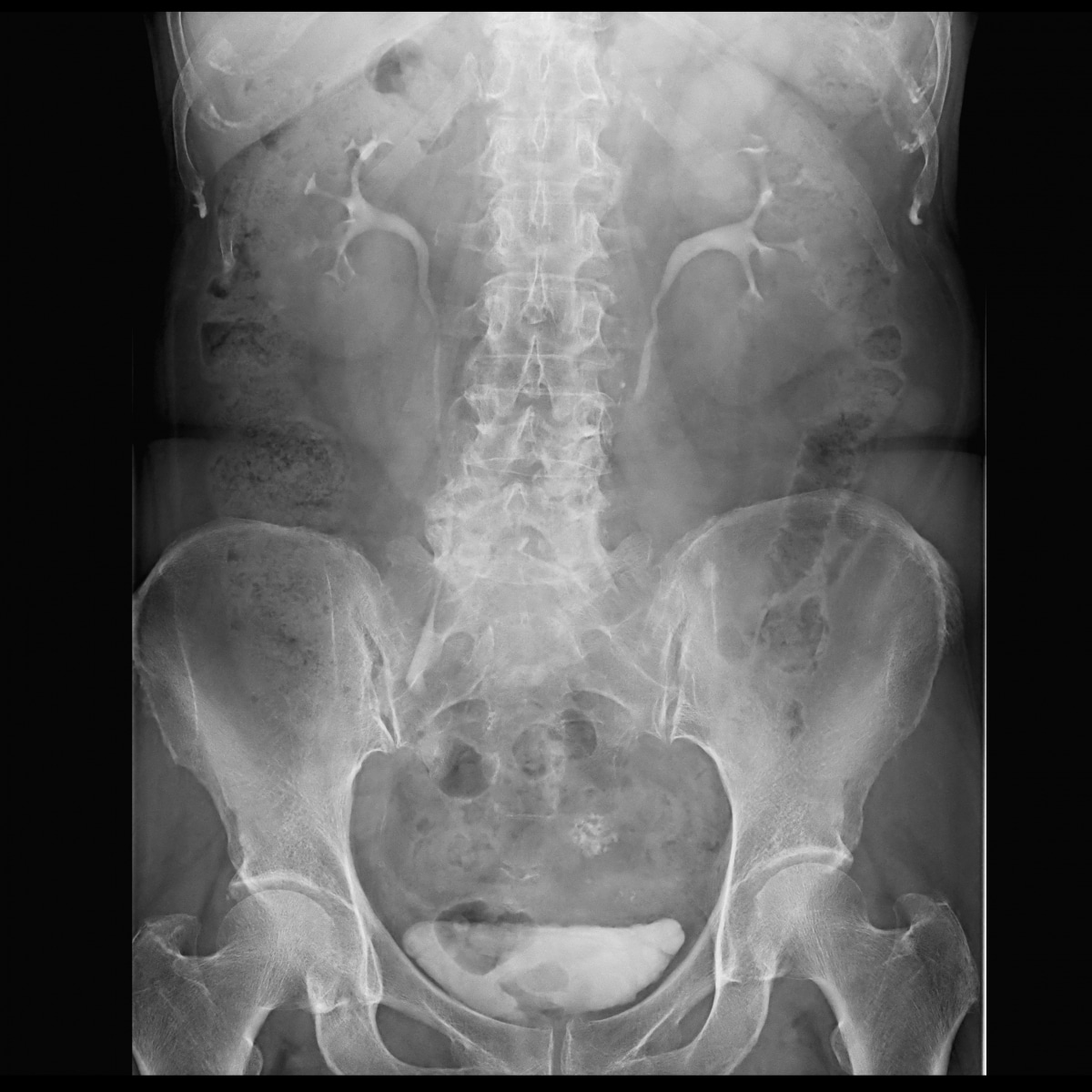 FLUOROspeed X1 edition SHIMADZU CORPORATION