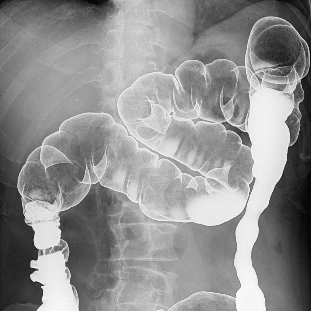 FLUOROspeed X1 edition SHIMADZU CORPORATION