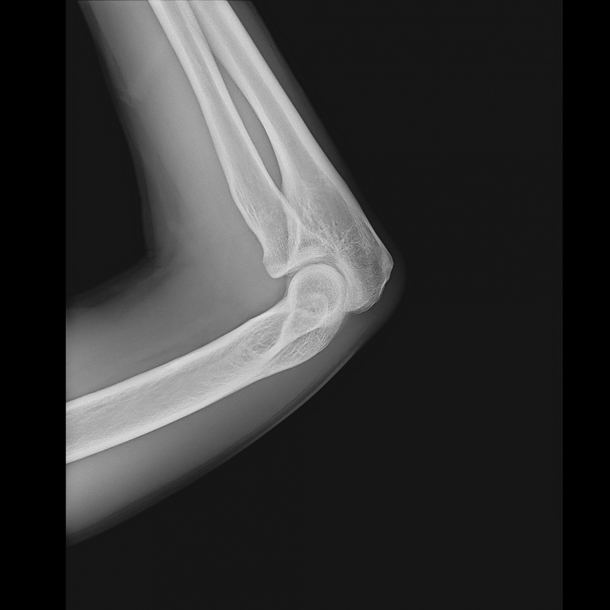 FLUOROspeed X1 edition SHIMADZU CORPORATION