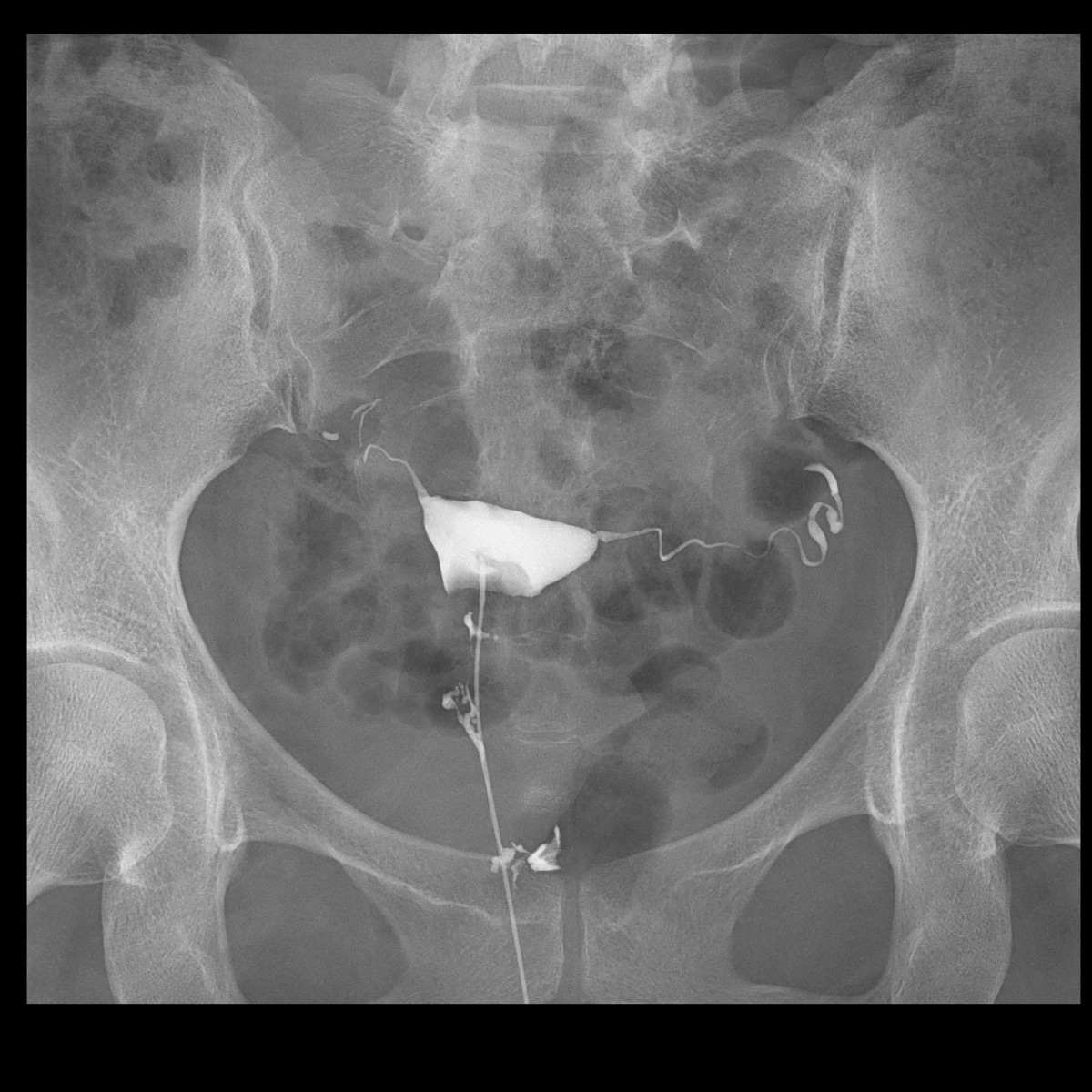 FLUOROspeed X1 edition SHIMADZU CORPORATION