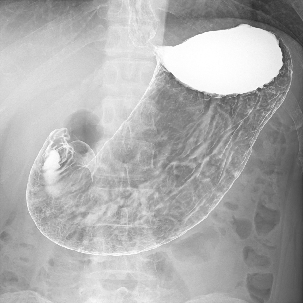 FLUOROspeed X1 edition SHIMADZU CORPORATION