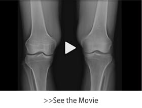 Slot Radiography