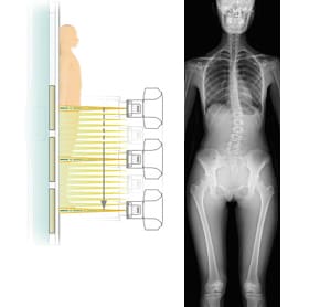 Slot Radiography