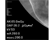 Exposure Dose Values in Real Time