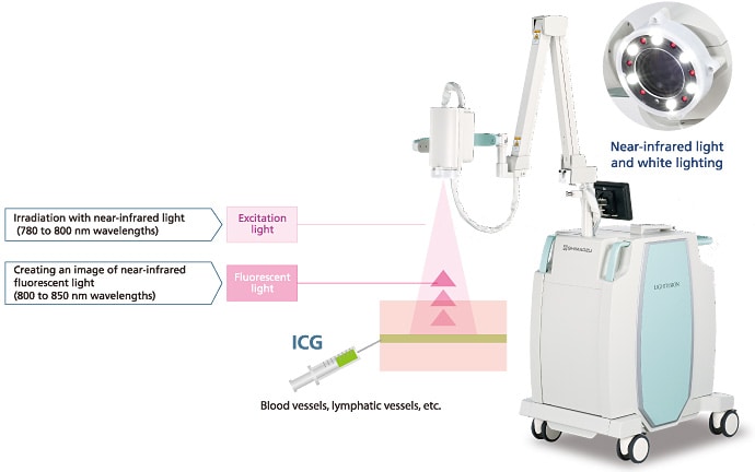 ICG Fluorescence using Near-infrared light