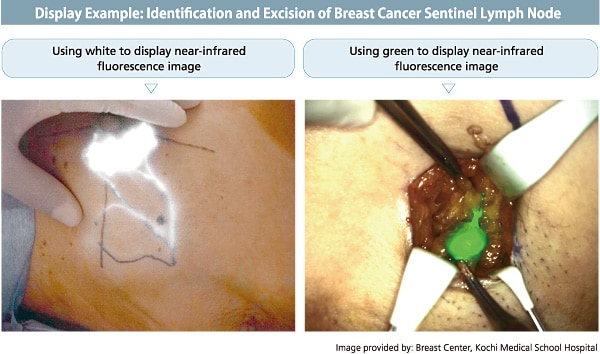 Colors Can Be Changed to Improve the Visibility of Blood Vessel or Lymph Duct