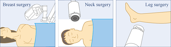 Freely Adjustable Camera Positioning