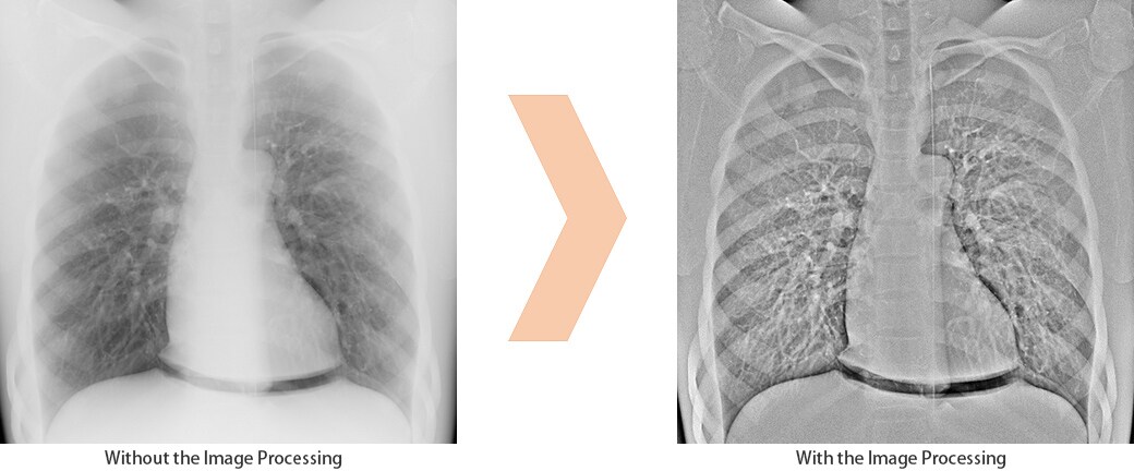 Edge Enhancement for Safer Procedures