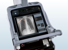 Processed image by Smart Tube