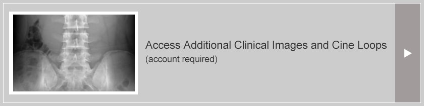 Access Additional Clinical Images and Cine Loops(account required)