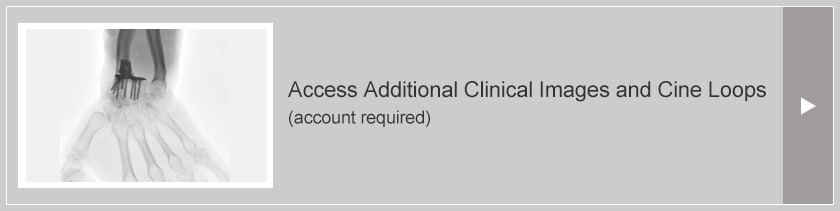 Access Additional Clinical Images and Cine Loops(account required)