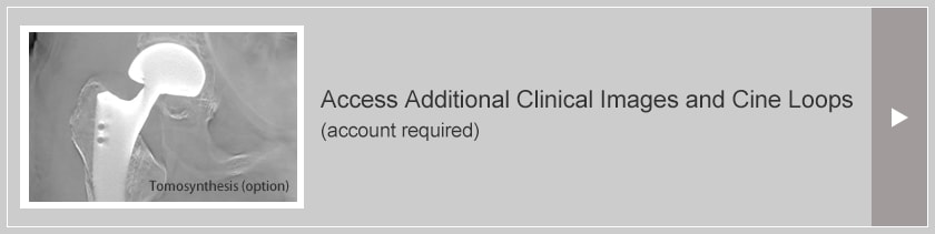 Access Additional Clinical Images and Cine Loops(account required)