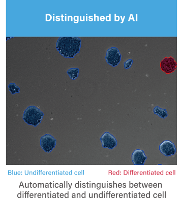 Distinguished by AI:Automatically distinguishes between differentiated and undifferentiated cell