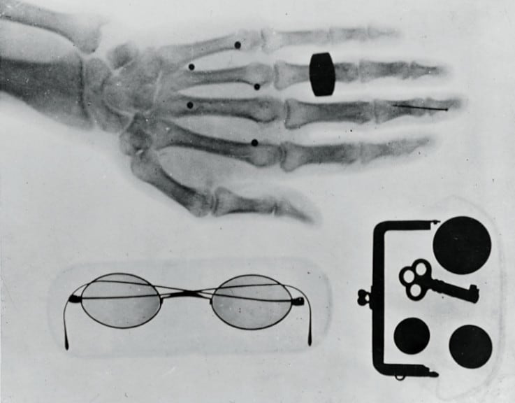 Early Radiograph Image