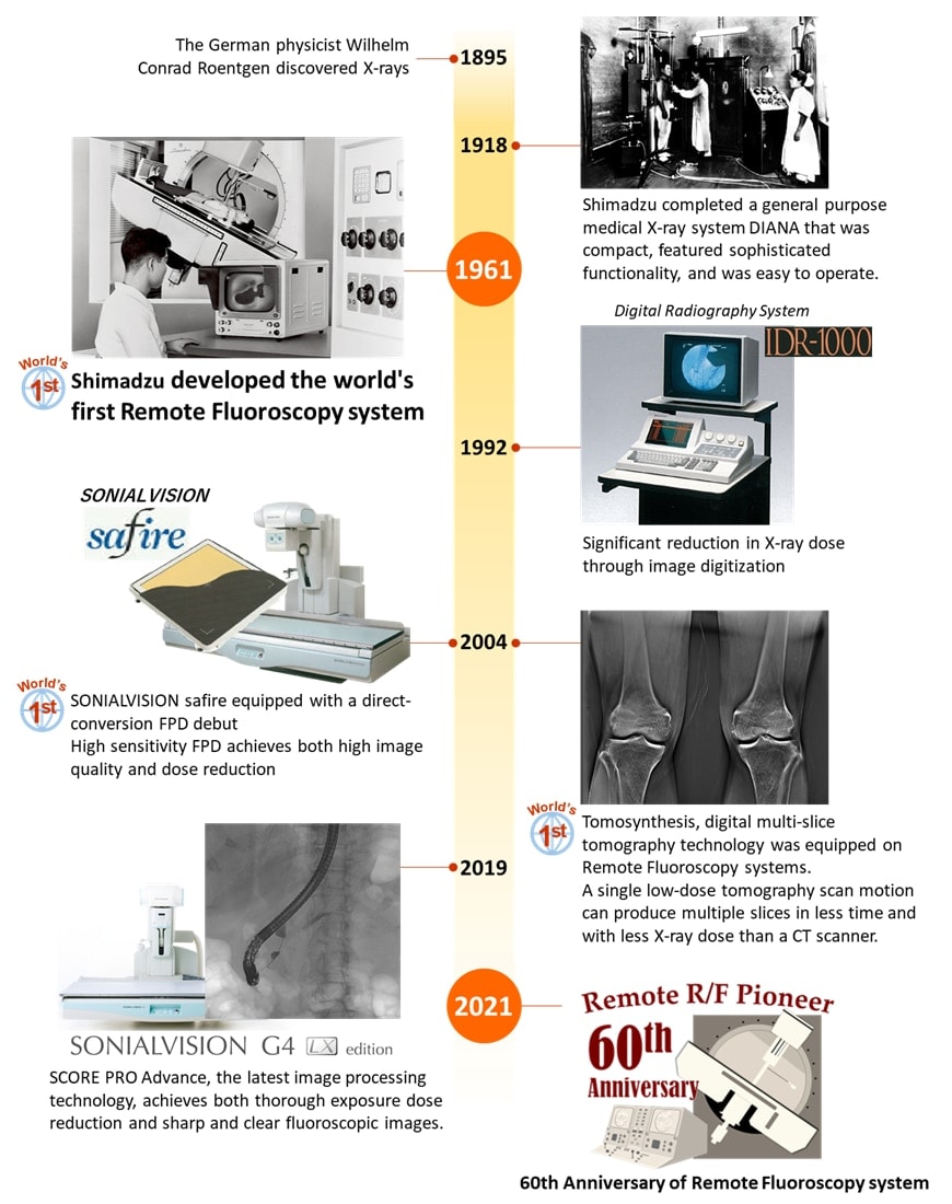 Milestones of Shimadzu Remote R/F system