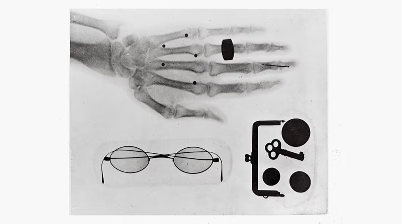 Hanichi Muraoka had promised to deliver the first successful X-ray photograph to his mentor at the Imperial University. Genzo later recalled, “I took a 24-hour train journey to Tokyo and presented the photograph to Professor Kenjiro Yamakawa.”*For this reason, the photograph produced at that time has not been preserved. Later, with successive improvements and experiments, the resolution of the X-ray photograph increased day by day. This photograph shows Muraoka’s eyeglasses, a coin pouch, and the hand of their assistant, Munesuke Kasuya.