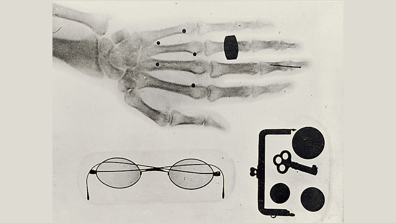 An early X-ray photograph