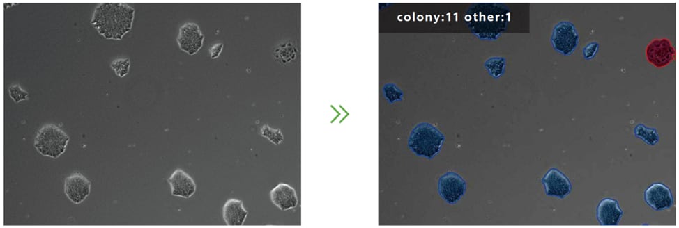 Abnormal Cell Detection Data Analysis Example (Blue is Normal and Red Abnormal)