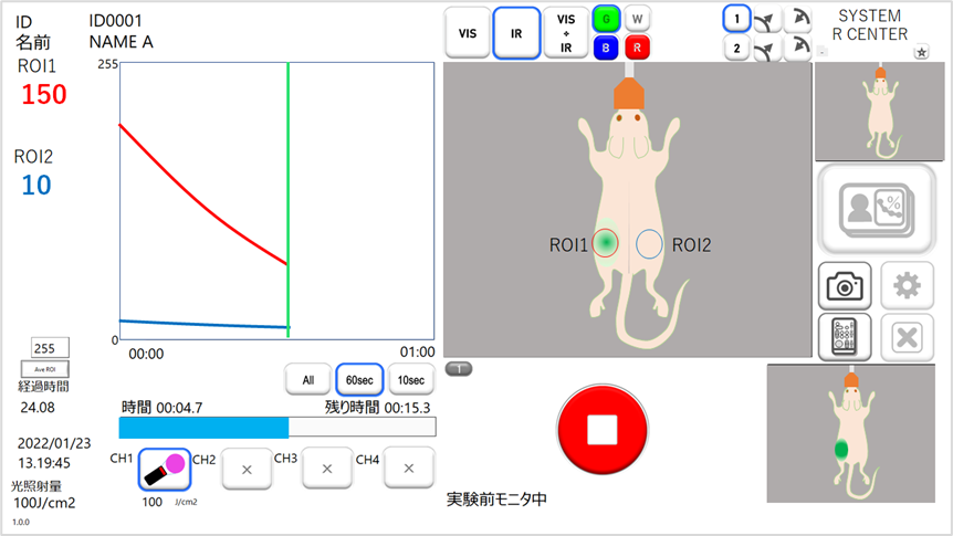 User Interface Screen for Imaging (Left Pane: Time-Intensity Curve Graph; Right Pane: Superimposed Images)