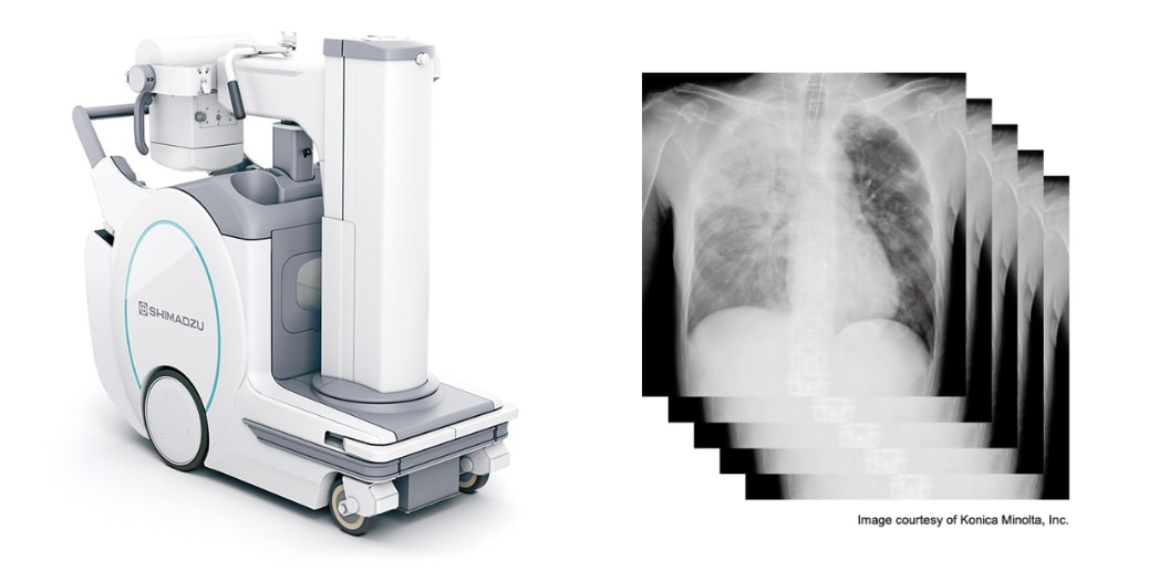 SHIMADZU CORPORATION : Dynamic Digital Radiology Added to Mobile X